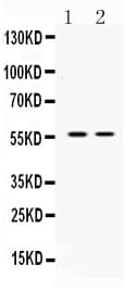 Polyclonal Rabbit anti-Human ANGPTL2 / ARP2 Antibody (IHC, WB)