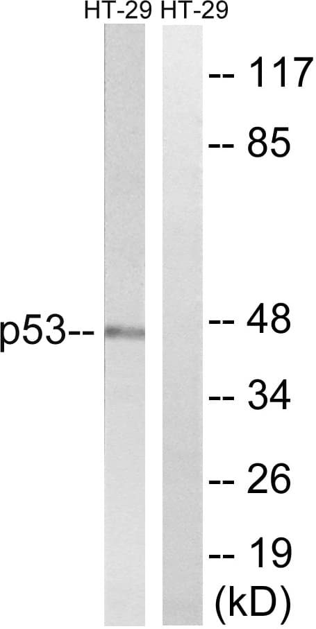 Polyclonal Rabbit anti-Human TP53 / p53 Antibody (aa334-383, WB)
