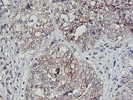 PDSS2 / DLP1 Antibody (clone OTI1D6)