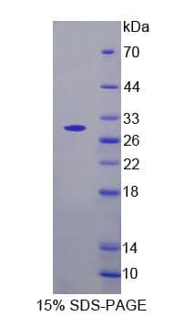 Rat GLRA2 Protein (Recombinant)