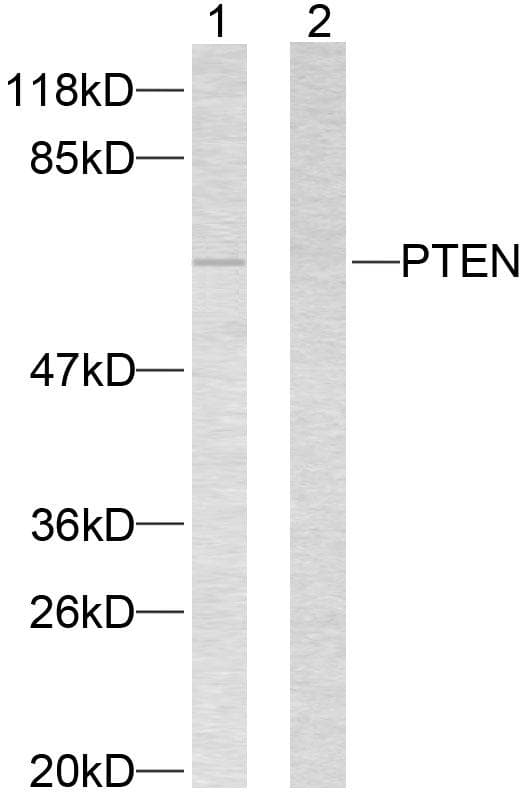 Polyclonal Rabbit anti-Human PTEN Antibody (p370, IHC, WB)