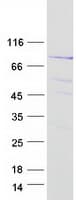 Human SGSM3 Protein (Recombinant Myc-DDK (Flag))