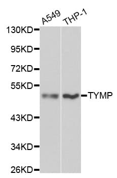 Polyclonal Rabbit anti-Human TP / Thymidine Phosphorylase Antibody (IHC, IF, WB)