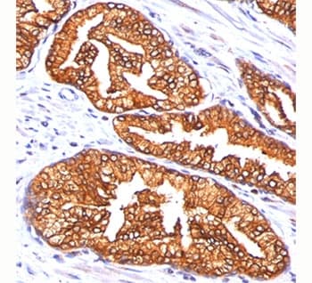 ODC1 / Ornithine Decarboxylase Antibody (clone ODC1/485)