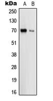 PathPlus™ UMOD / Uromodulin Antibody (Internal)