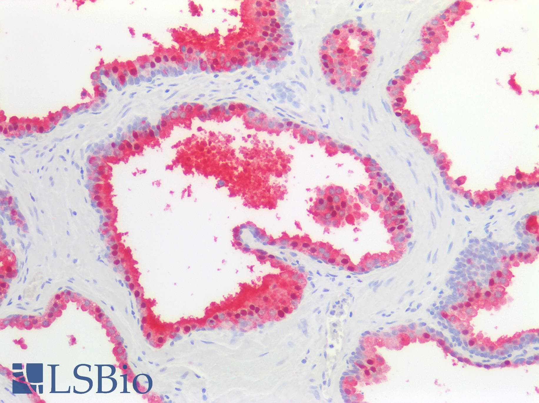 PathPlus™ IDH1 / IDH Antibody (clone AT25H10)
