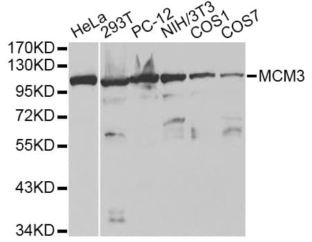Polyclonal Rabbit anti-Human MCM3 Antibody (IHC, IF, WB)