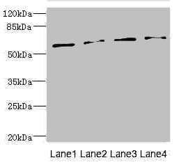 Polyclonal Rabbit anti-Human TCBE / KCS / HRD Antibody (IHC, WB)