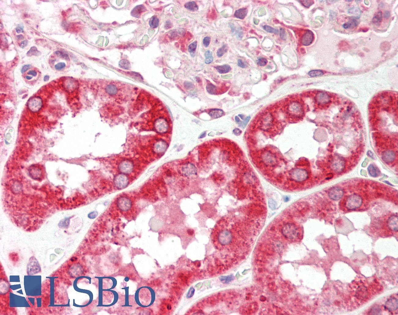 Polyclonal Rabbit anti-Human CES2 / Esterase Antibody (C-Terminus, IHC, IF, WB)
