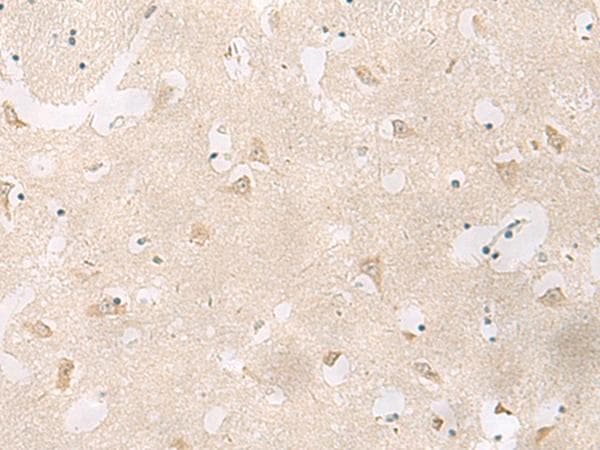 Polyclonal Rabbit anti-Human GPR83 Antibody (IHC)