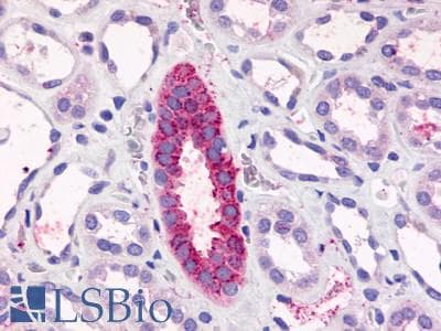 PathPlus™ Polyclonal Rabbit anti-Human TAAR6 Antibody (C-Terminus, IHC)