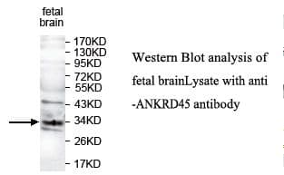 Polyclonal Rabbit anti-Human ANKRD45 Antibody (aa72-258, IHC, WB)