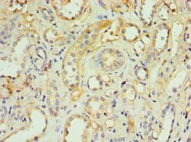 TRAIL-R4 / DCR2 Antibody (aa257-386)