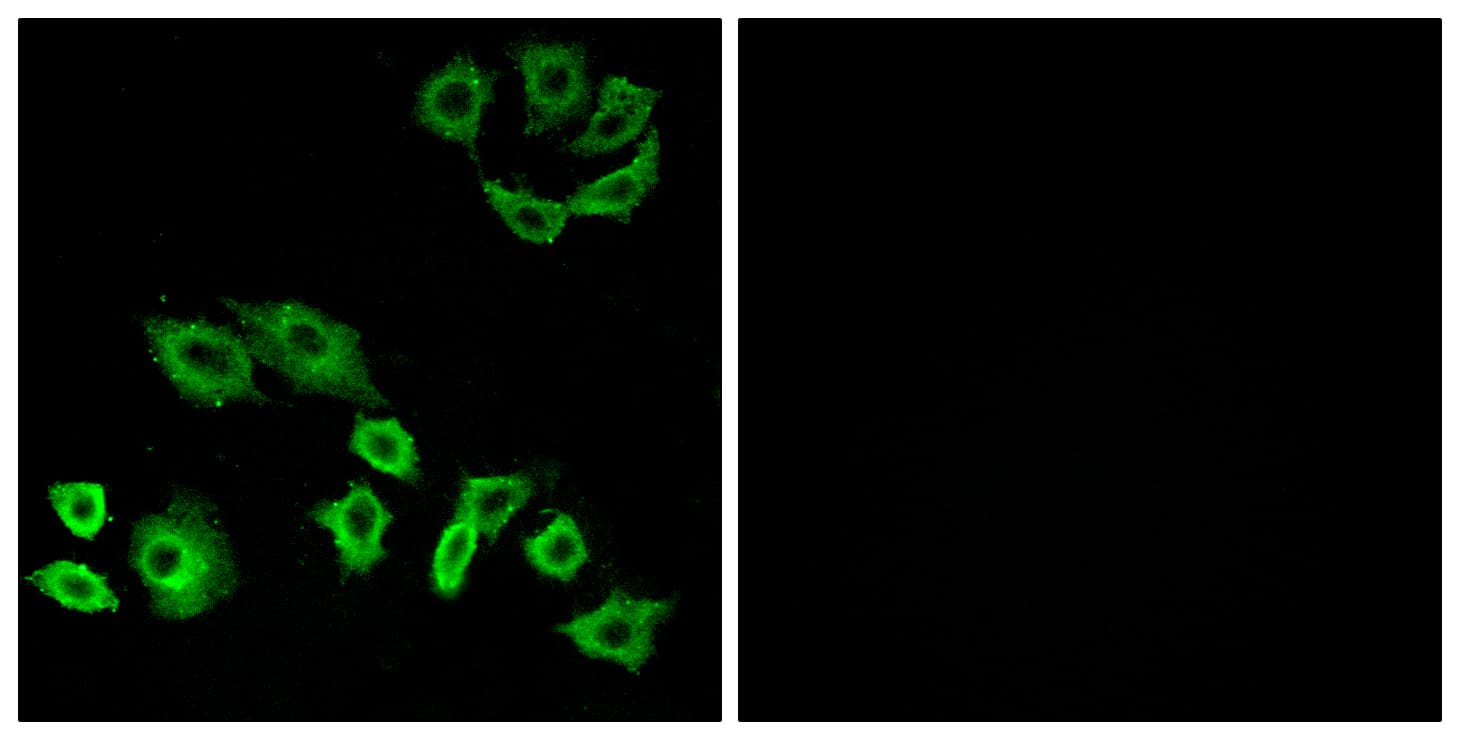 IHC-plus™ TTF / RHOH Antibody (aa141-190)