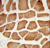 Polyclonal Rabbit anti-Human ECI2 / PECI Antibody (aa331-358, IHC, WB)