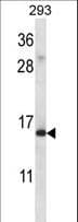 Polyclonal Rabbit anti-Human RPS19 / Ribosomal Protein S19 Antibody (aa105-133, WB)