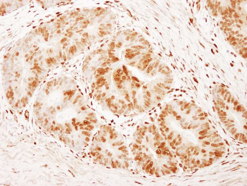 Polyclonal Rabbit anti-Human FOXK1 / MNF Antibody (aa525-575, IHC)