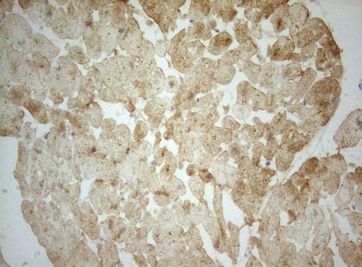 Adiponectin Antibody (aa19-244, clone OTI2G8)