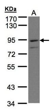 IHC-plus™ Polyclonal Rabbit anti-Human PTGFRN Antibody (aa815-879, IHC, WB)