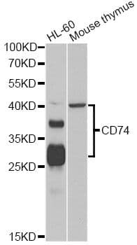 Polyclonal Rabbit anti-Human CD74 / CLIP Antibody (WB)