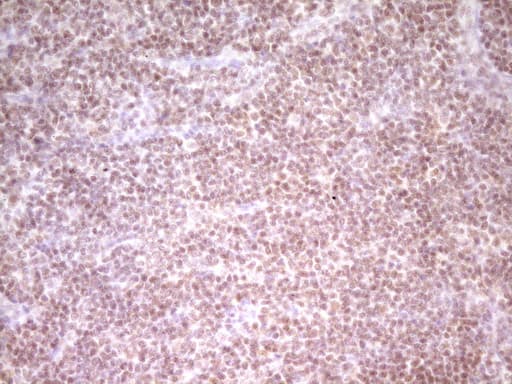 NR2C2 / TAK1 Antibody (aa1-241, clone OTI1F3)