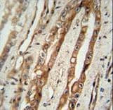 SERPING1 / C1 Inhibitor Antibody (aa285-314)