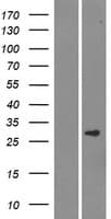 SMCO3 Protein (Over-Expression Lysate Myc-DDK (Flag))