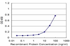 MMP3 Antibody (clone 4C11)