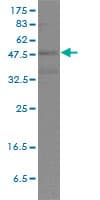 Monoclonal Mouse anti-Human POU2F2 / OCT2 Antibody (clone 3E3-6F9, IHC, WB)