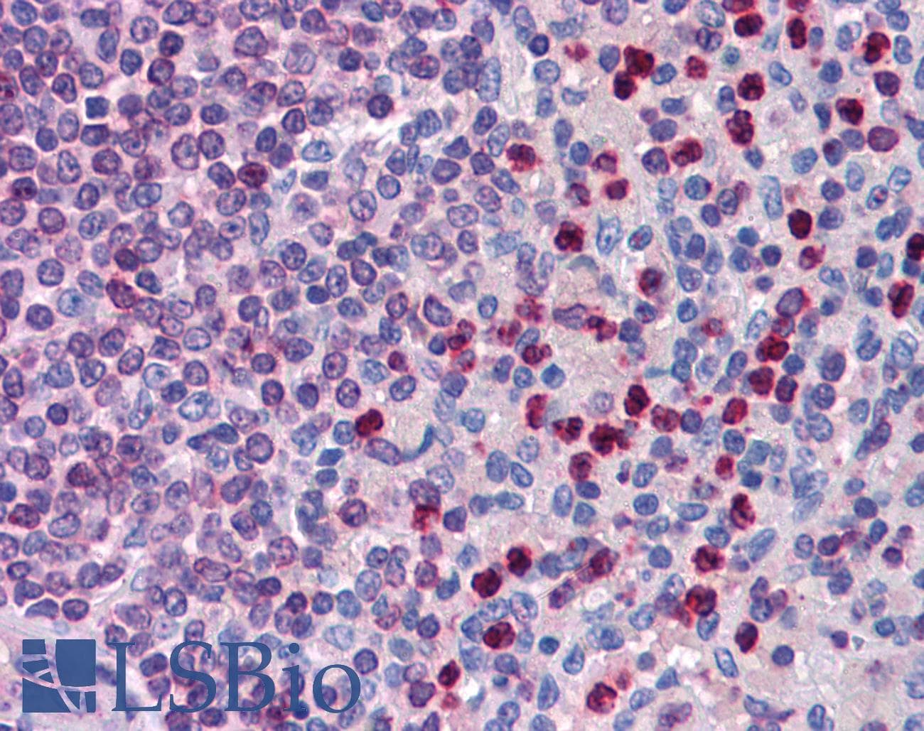 IHC-plus™ Polyclonal Goat anti-Human ALOX5AP / FLAP Antibody (aa28-40, IHC, WB)