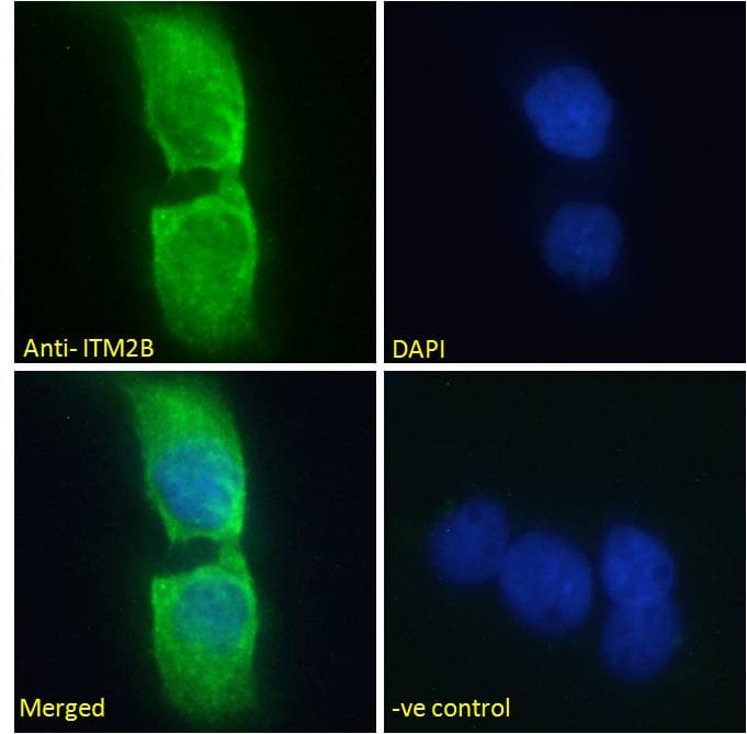 IHC-plus™ ABRI / ITM2B Antibody (aa224-238)