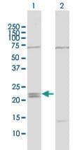 IFNE / Interferon Epsilon Antibody
