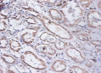 PRKCSH Antibody