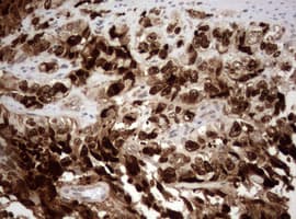 MKI67 / Ki67 Antibody (aa1160-1493, clone OTI5E6)