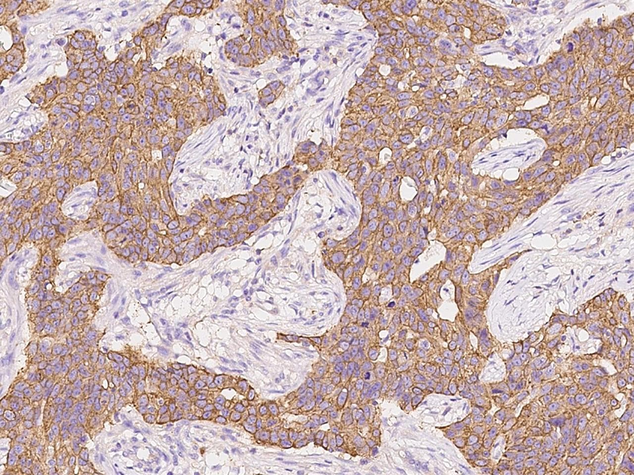 Polyclonal Rabbit anti-Human KRT24 / Keratin 24 Antibody (IHC)