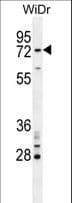 BARD1 Antibody (aa101-131)