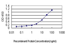 KIF2A Antibody (clone 2D4)