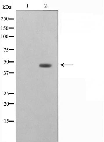 STRADA / LYK5 Antibody