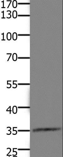 HOXD11 Antibody