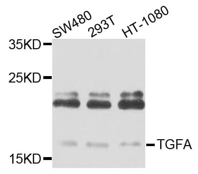 IHC-plus™ TGFA / TGF Alpha Antibody