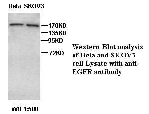 Polyclonal Rabbit anti-Human EGFR Antibody (IHC, WB)
