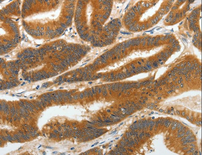 Polyclonal Rabbit anti-Human RGS2 Antibody (IHC)