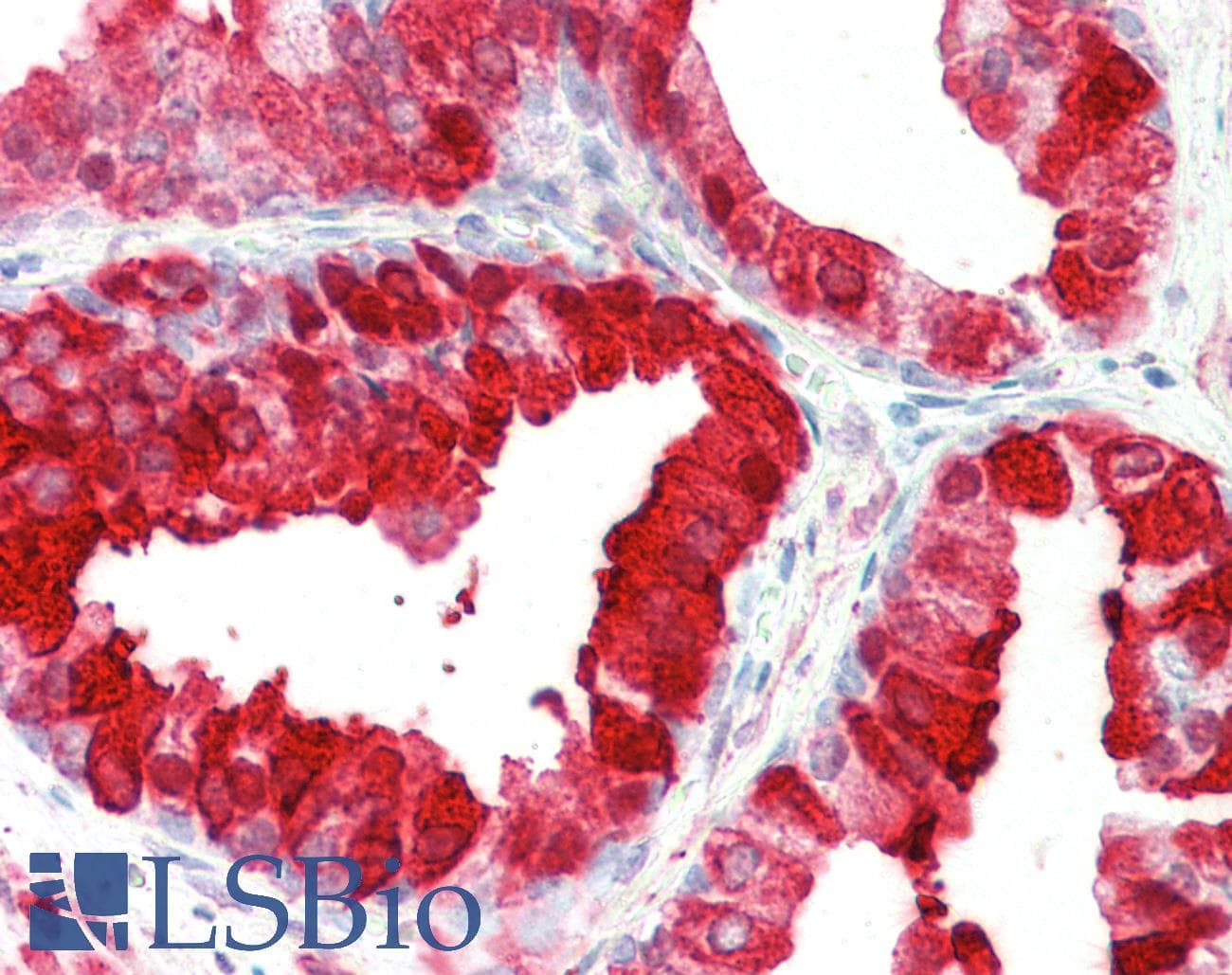 PathPlus™ Polyclonal Goat anti-Human KLK6 / Kallikrein 6 Antibody (aa145-156, IHC)