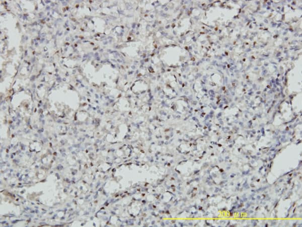 Monoclonal Mouse anti-Human MEIS2 Antibody (clone 1H4, IHC, IF, WB)