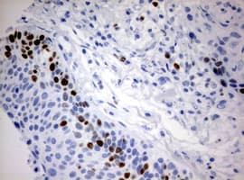 MKI67 / Ki67 Antibody (aa1160-1493, clone OTI13B11)