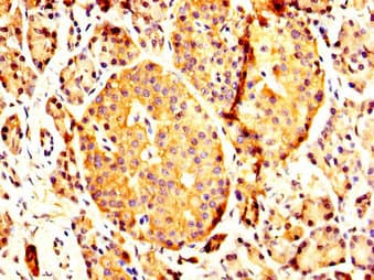 Polyclonal Rabbit anti-Human PCMT1 Antibody (IHC)