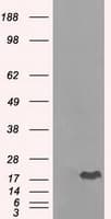 CRYAB / Alpha B Crystallin Antibody (clone OTI3C2)