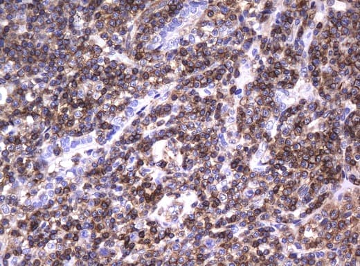 DEF6 Antibody (clone UMAB51)