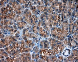 PIM2 / Pim-2 Antibody (clone OTI8G10)