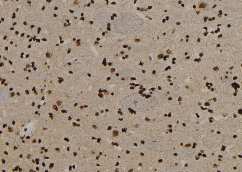 USP29 Antibody